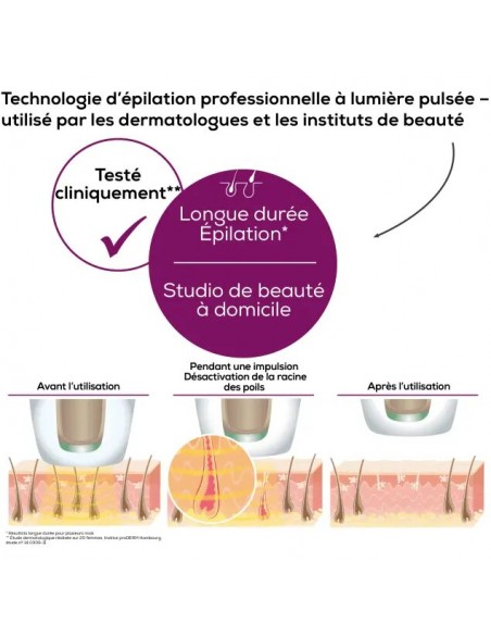 Appareil D'épilation Beurer IPL VelvetSkinPro Black Appareil D'épilation Beurer IPL VelvetSkinPro Black