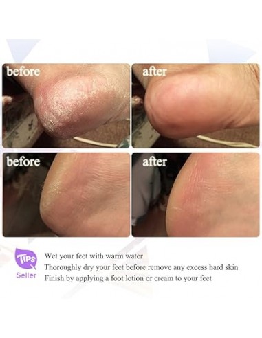 Set de Manucure et Pédicure 9 en 1, Râpe électrique TouchBeauty TB-0601B