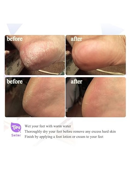 Set de Manucure et Pédicure 9 en 1, Râpe électrique TouchBeauty TB-0601B